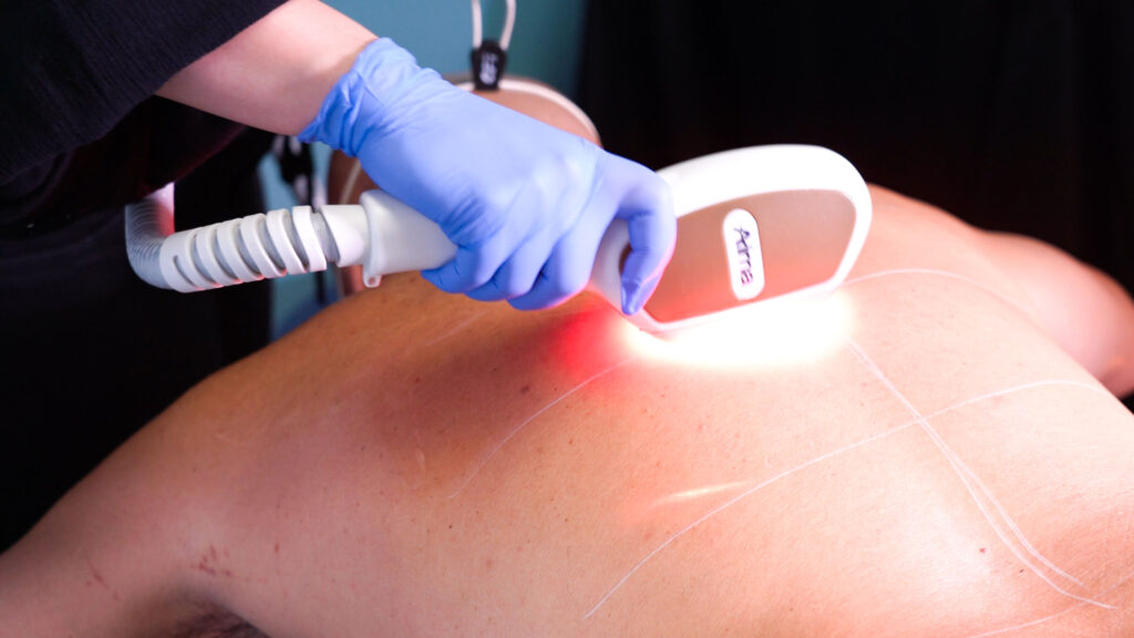 Close-up image of a med spa technician aiming a handheld laser device at a client's back for laser hair removal.