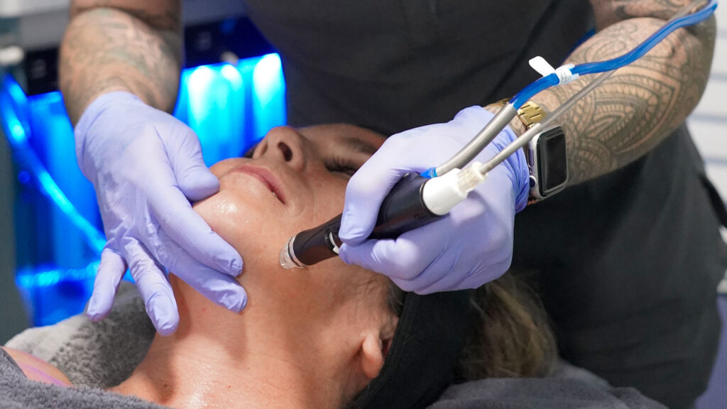 Close-up image of a med spa beautician using a handheld hydrafacial device with a spiral tip on a client's face. The device is gently exfoliating, extracting impurities, and infusing hydrating serums into the skin for a clearer, more radiant complexion.