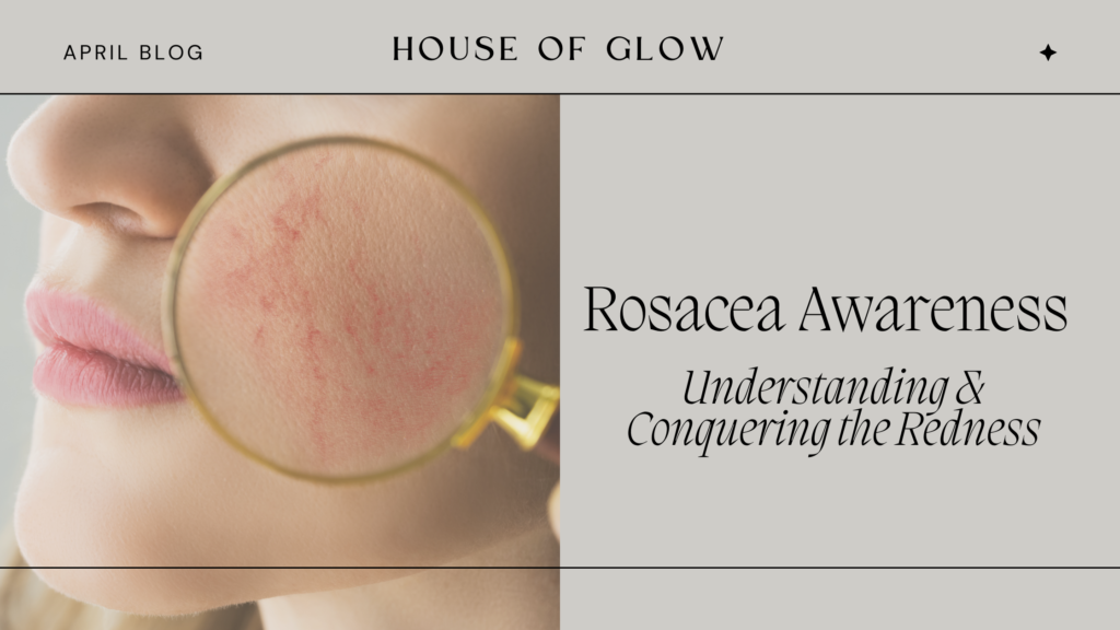 Unveiling Rosacea: Understanding and Conquering the Redness