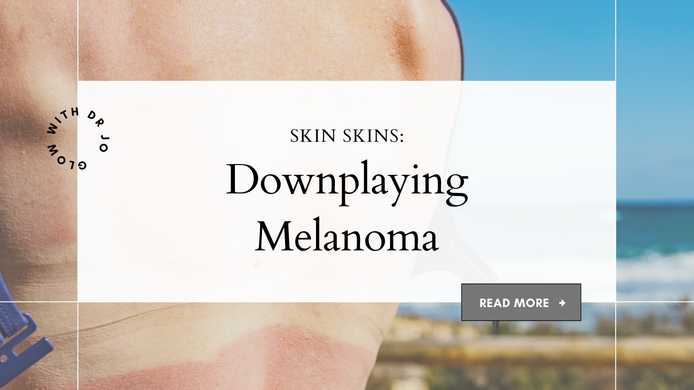 Skin Wins and Sins: Melanoma